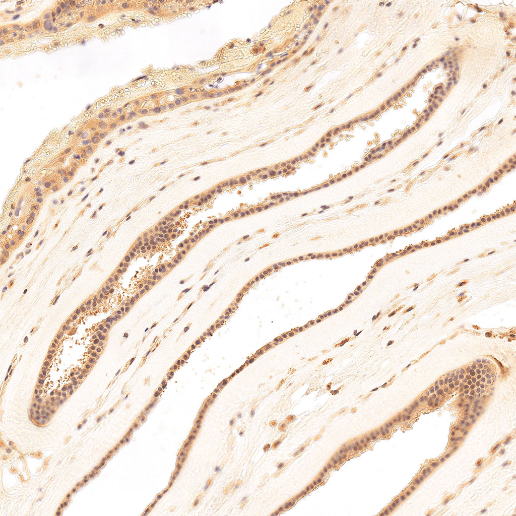 sars-cov-2 gene expression in a human fetus